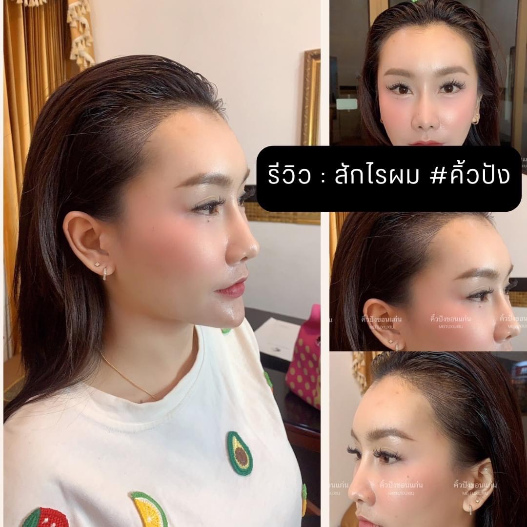 ปฏิเสธไม่ได้ถ้าปัญหา